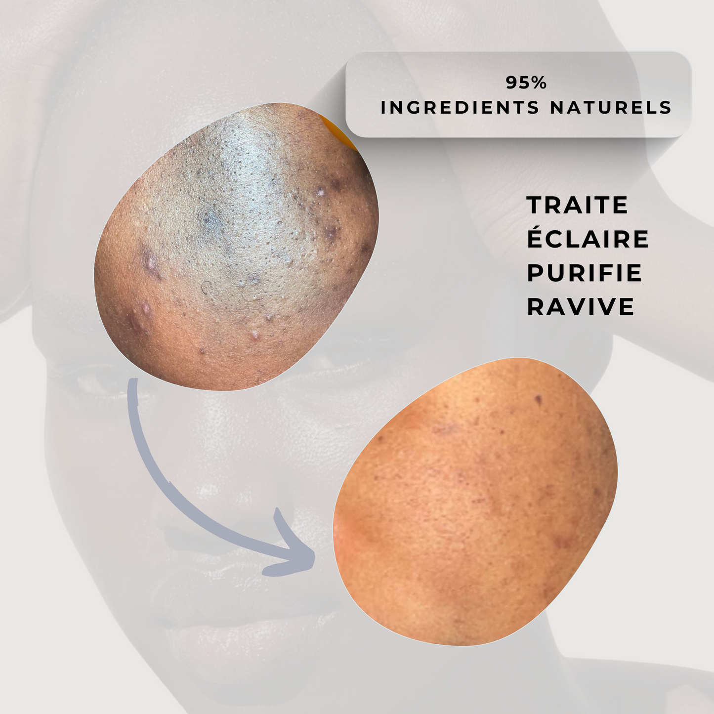 Diamond Face